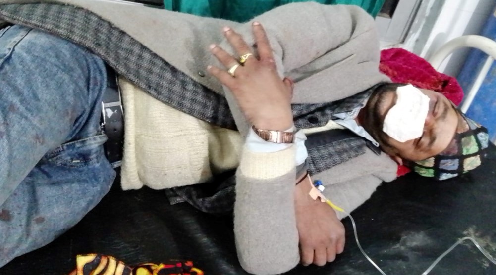 डेउडा गायक जोशीमाथि कुटपिट